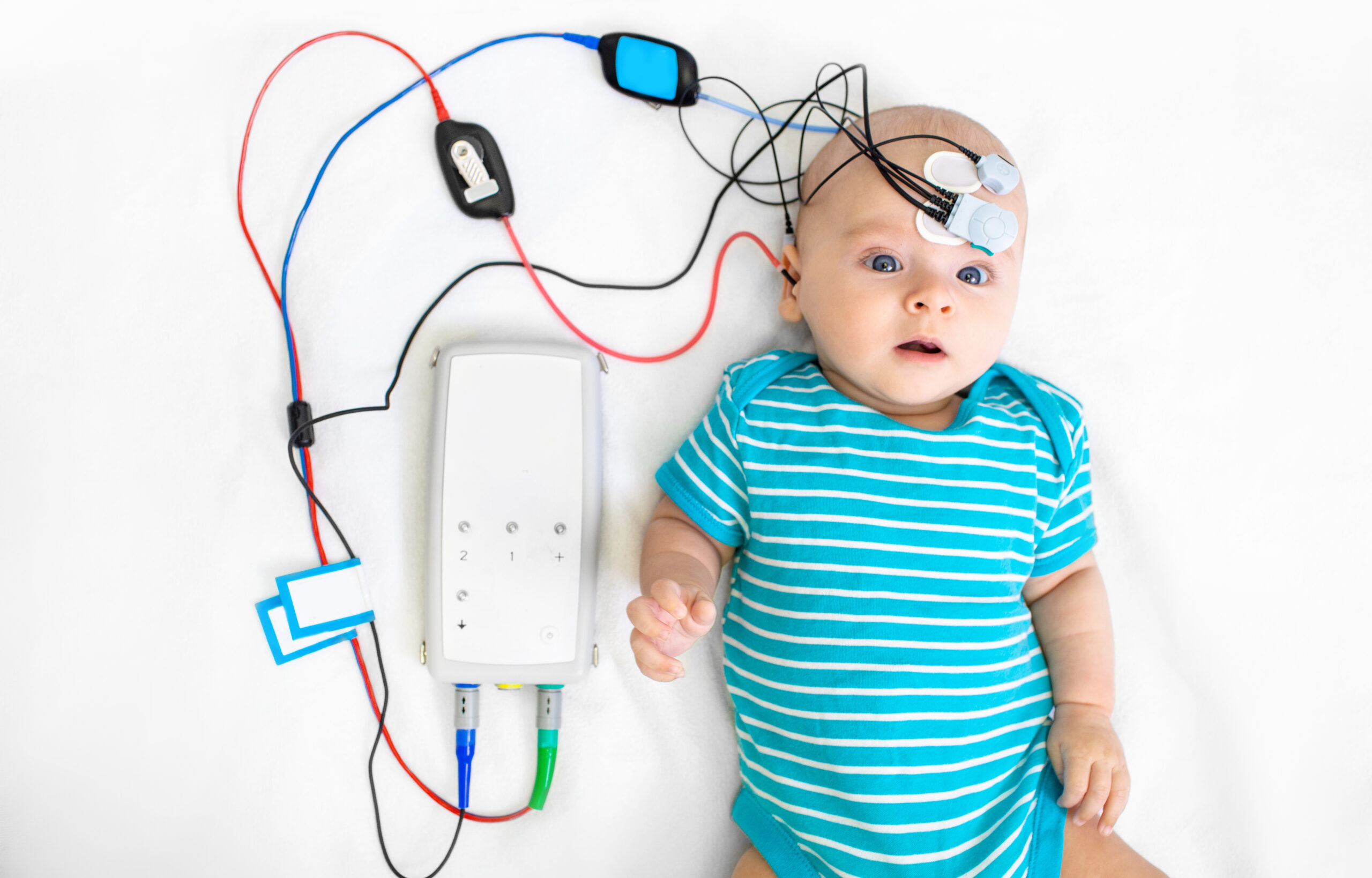 Newborn hearing screening and diagnosis at the hospital. Baby having hearing screening with special electrodes on his head and ear